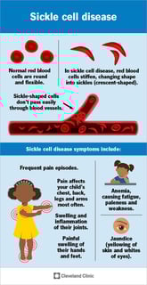 Picture of sickle-cell disease