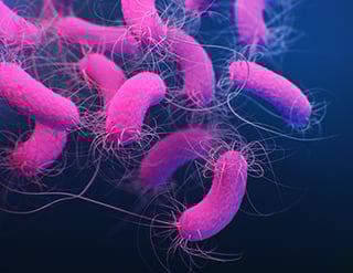 Picture of Pseudomonas aeruginosa