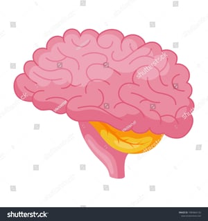 Picture of transient cerebral isolation