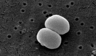 Picture of Staphylococcus epidermidis