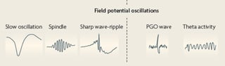 Picture of Slow-wave sleep