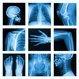 Picture of X-ray