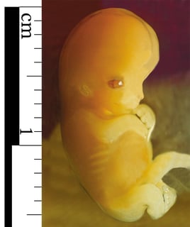 Picture of Embryo