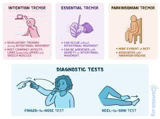 Picture of tremor