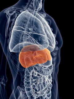 Picture of hepatitis