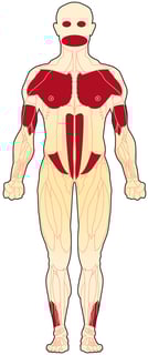 Picture of facioscapulohumeral muscular dystrophy