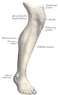 Picture of human leg