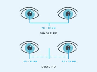 Picture of Pupillary distance