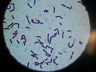 Picture of Bacillus cereus