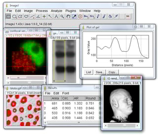 Picture of ImageJ