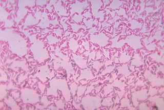 Picture of Bacteroides