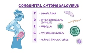 Picture of Congenital cytomegalovirus infection