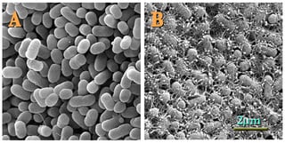 Picture of Escherichia coli O157:H7