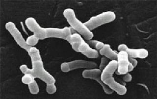 Picture of Bifidobacterium longum