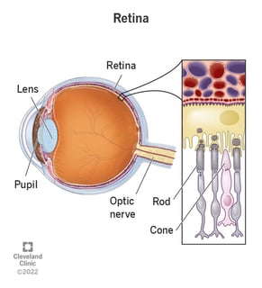 Picture of retina