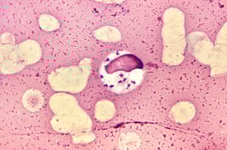 Picture of Leishmania