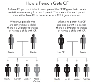 Picture of cystic fibrosis