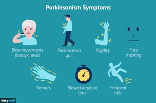 Picture of parkinsonian syndrome
