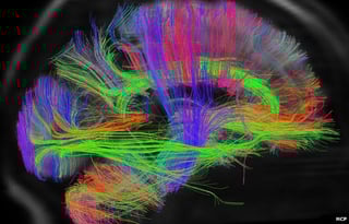 Picture of Human Connectome Project