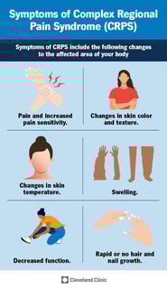 Picture of complex regional pain syndrome