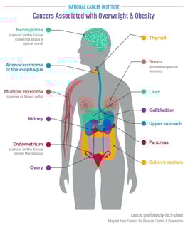 Picture of obesity