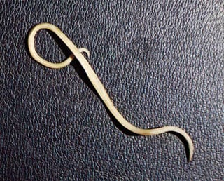 Picture of Roundworm