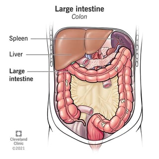 Picture of Large intestine