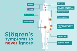 Picture of Sjögren's syndrome