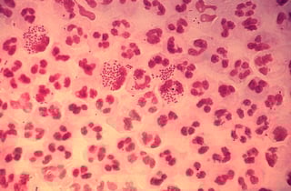 Picture of Neisseria gonorrhoeae