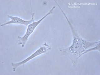 Picture of fibroblast