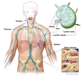 Picture of Non-Hodgkin lymphoma