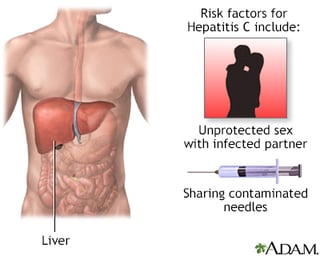 Picture of hepatitis C