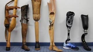 Picture of Prosthesis