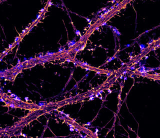 Picture of Super-resolution imaging