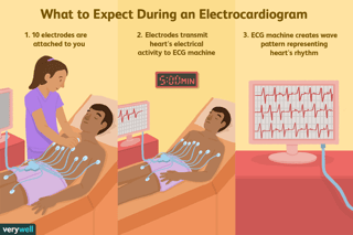 Picture of Electrocardiography