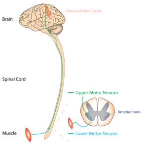 Picture of Motor neuron disease