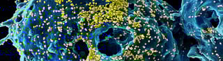 Picture of MERS-related coronavirus