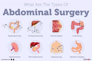 Picture of Abdominal surgery