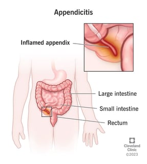 Picture of appendix