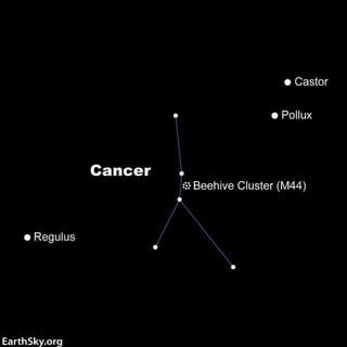 Picture of Cancer