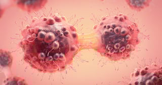 Picture of cancer