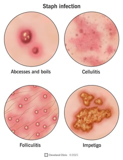 Picture of Staphylococcus