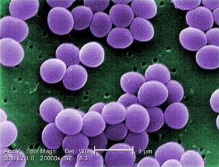 Picture of Staphylococcus aureus