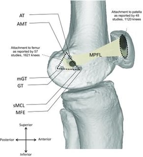 Picture of Medial patellofemoral ligament