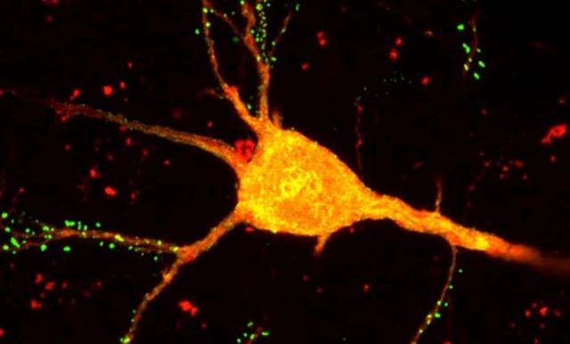A cortical neuron labeled with monosynaptic rabies virus (orange). Credit: Salk Institute