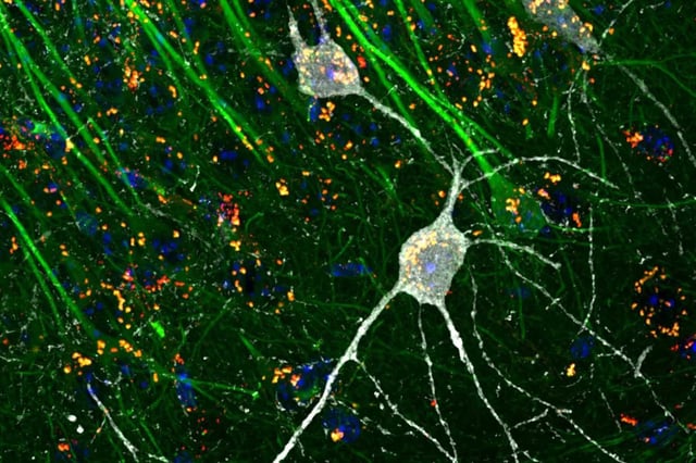 Snapshot of a specialised nerve cell, called an interneuron, undergoing autophagy in the hippocampus - a key brain region for memory function. (Image: Anna Rappe)