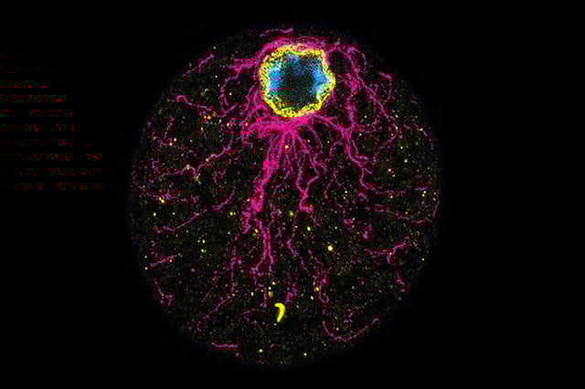 A cell of the ichthyosporean C. perkinsii showing distinct signs of polarity, with clear cortical localization of the nucleus before the first cleavage. Microtubules are shown in magenta, DNA in blue, and the nuclear envelope in yellow. © DudinLab