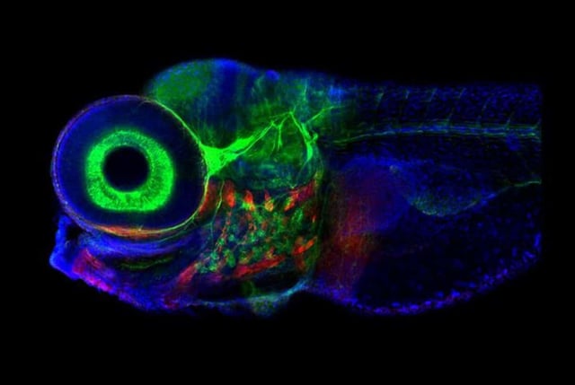 Zebrafish, photographed with confocal microscope. The brain region that controls eye movement is structurally similar in fish and mammals, but the zebrafish system contains only 500 neurons, making it a good model organism. Credit: Jessica Plavicki
