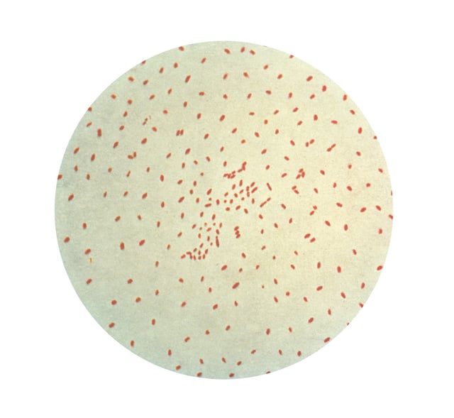 1979 Photomicrograph of Haemophilus (Bordetella) pertussis (Bordet - Bongou bacillus) Bacillus of whooping cough. Gram stain http://www.cdc.gov/ncidod/diseases/submenus/sub_pertussis.htm S 11, slide 17; C 57592