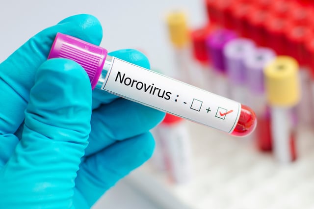 The CDC reports double the cases of stomach flu.